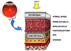 The Retina