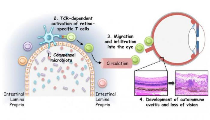 Diagram showing how Microbes can cause vison loss