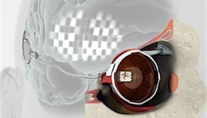 Sketch of a bionic eye or retinal microchip