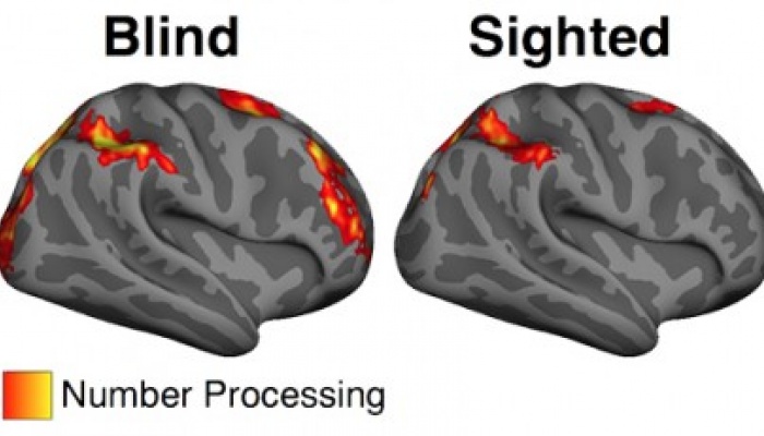 MRI brain scans showing areas used during math computations for blind and sighted people