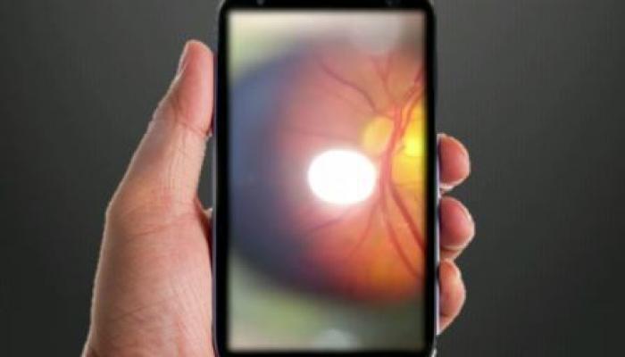 Smartphone that does eye exams