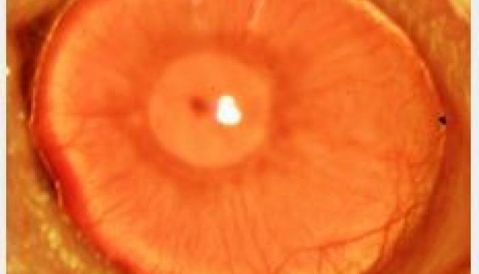 Cornea shown enlarged