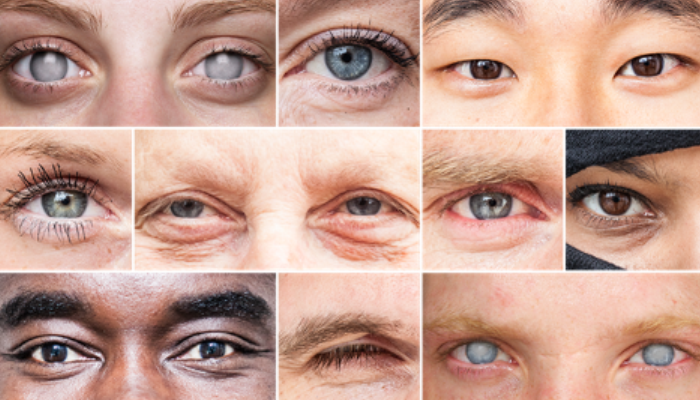 collage of eyes