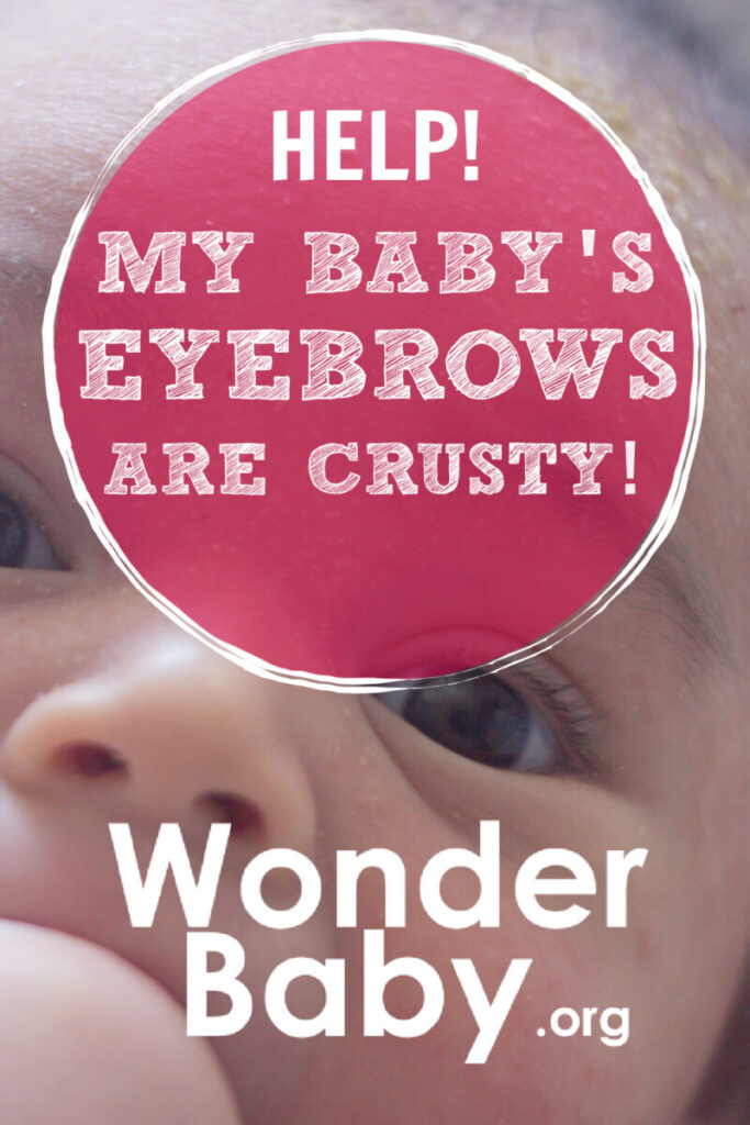 Help! My Baby’s Eyebrows Are So Crusty!