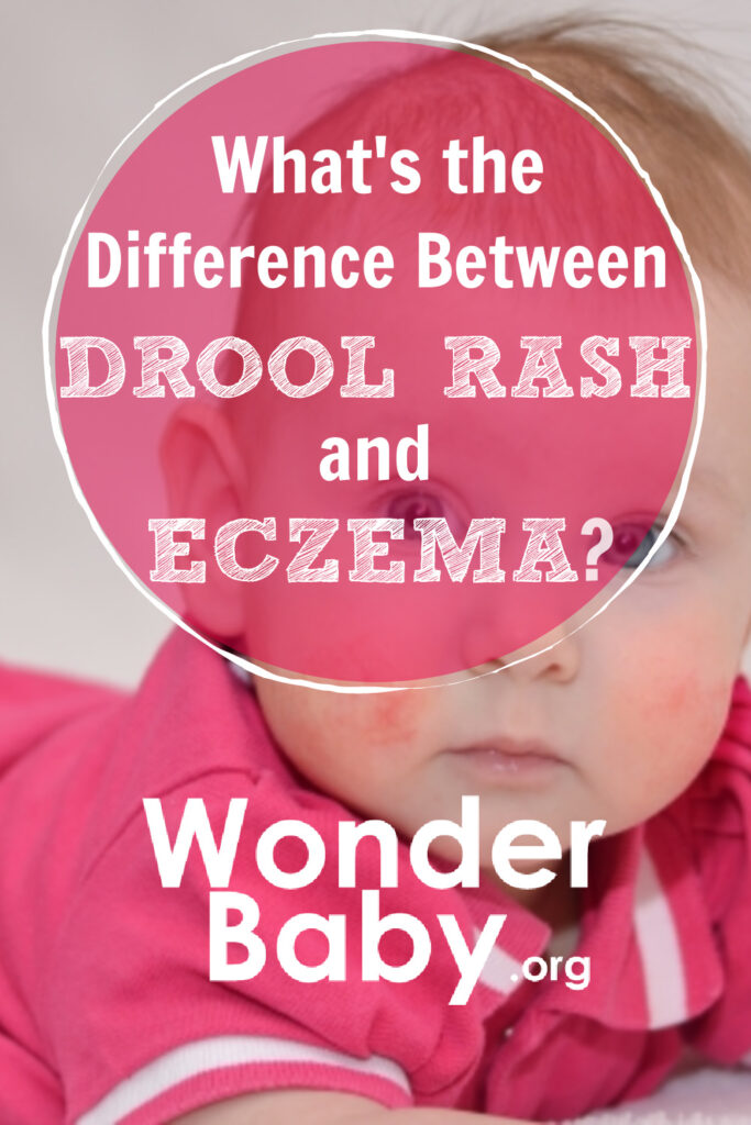 What's the difference between drool rash and eczema?