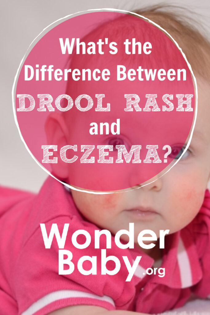 Drool Rash Vs Eczema How To Tell The Difference