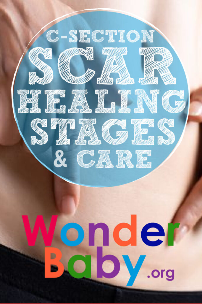 C-Section Scar Healing Stages and Care Pin