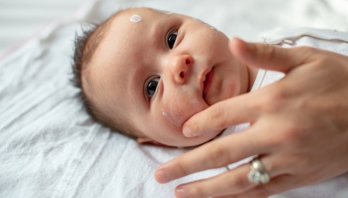 Mother applying antiallergic cream at baby face with skin rash and allergy.