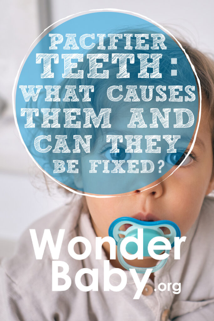 Pacifier Teeth: What Causes Them and Can They Be Fixed