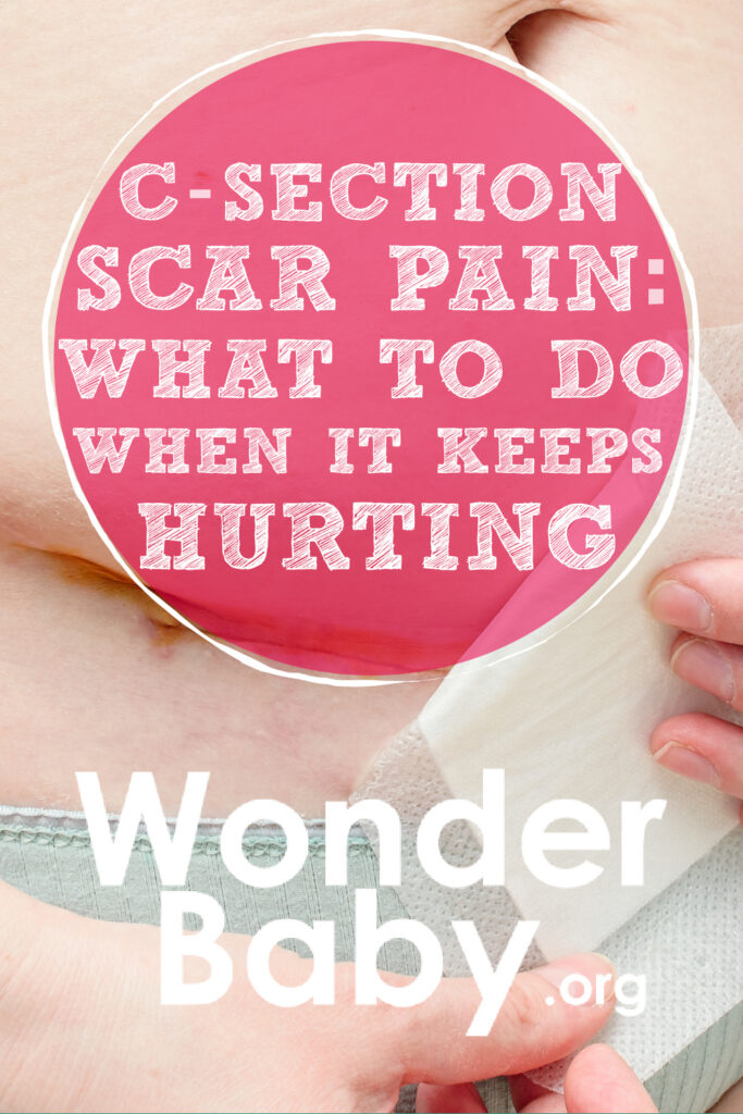 C-Section Scar Pain: What to Do When It Keeps Hurting