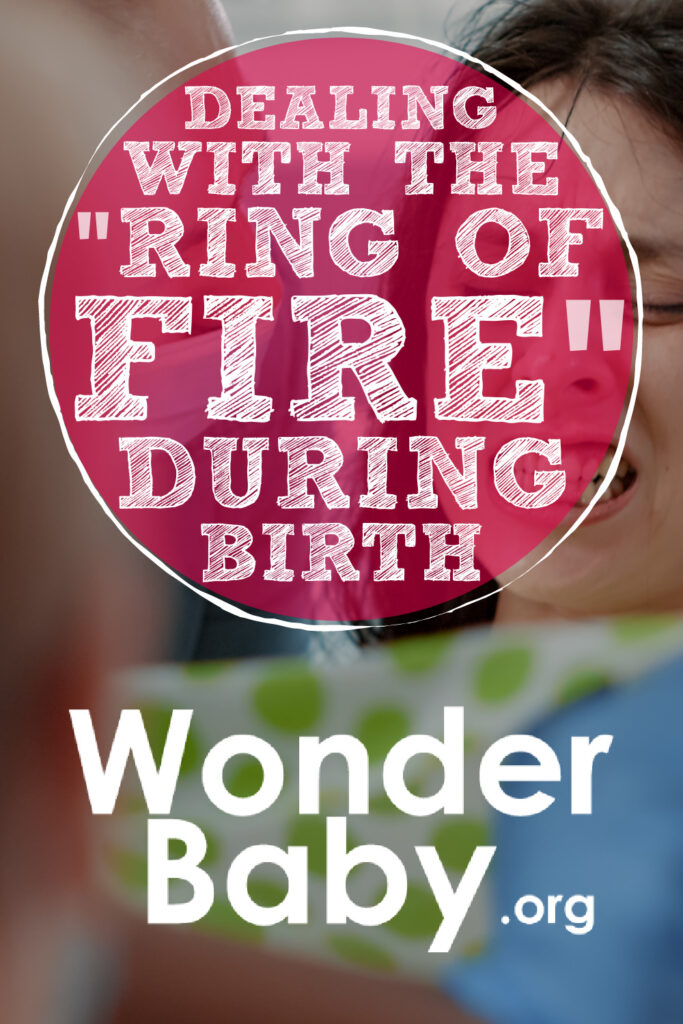 Dealing With the “Ring of Fire” During Birth