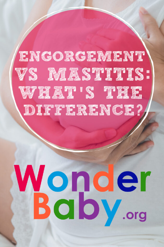 Engorgement vs Mastitis: What’s the Difference