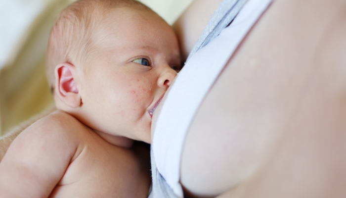 Newborn baby breastfeeding with a baby acne on face.