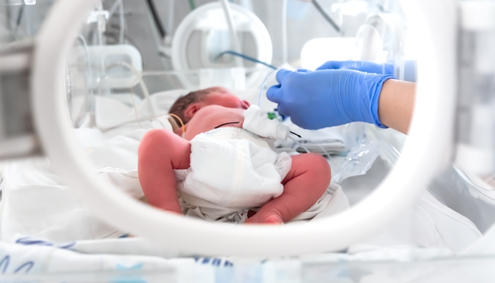 Photo of a premature baby in incubator.