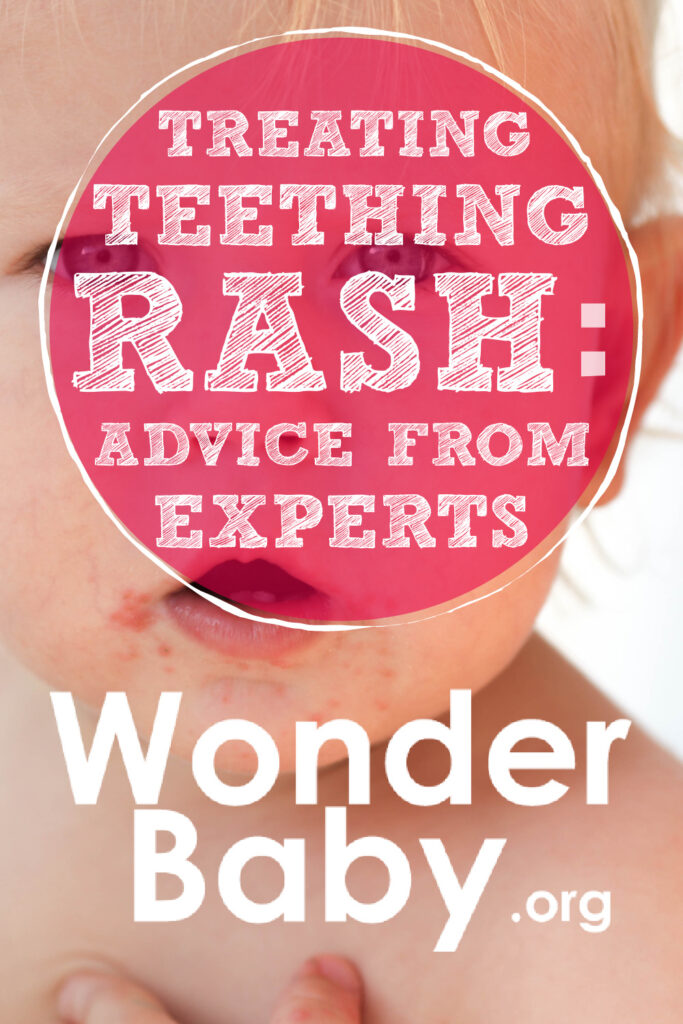 Treating Teething Rash: Advice From Experts