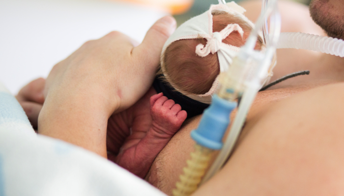 NICU baby laying on parent's chest.