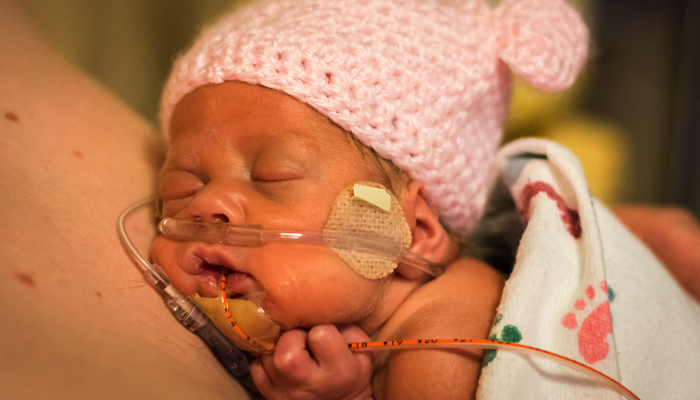 NICU baby laying on parent's chest.