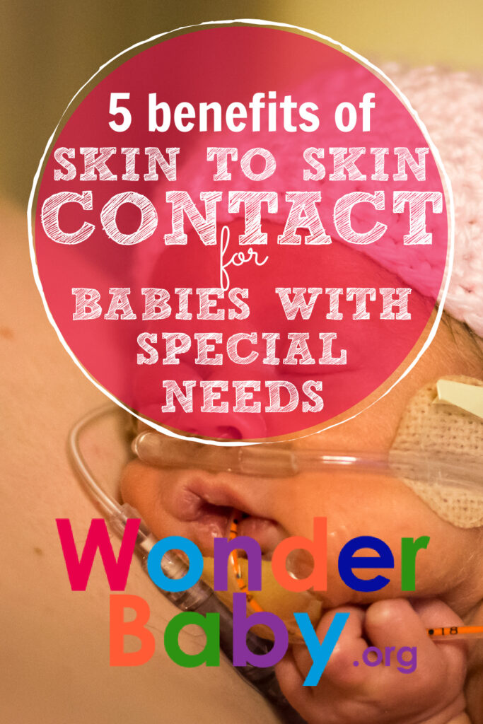 5 Benefits of Skin-to-Skin Contact for Babies With Special Needs