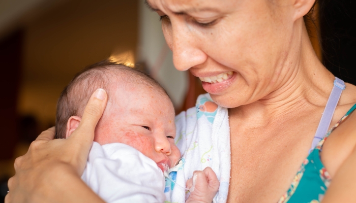 A worried mother holding her sick newborn baby at home. Infant suffering from eczema and throwing up.