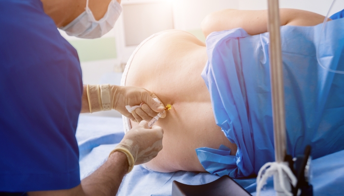 Epidural anesthesia injections.