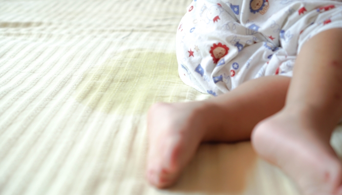 Bed wet situation of toddler girl.