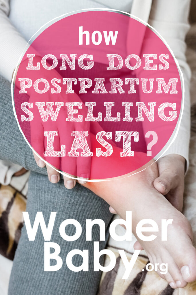 How Long Does Postpartum Swelling Last?
