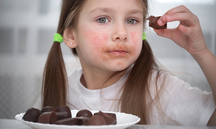A little girl with an allergic rash on her cheeks sits at a table next to chocolates,