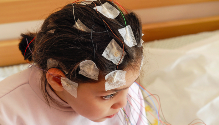 A girl with EEG leads on her head.