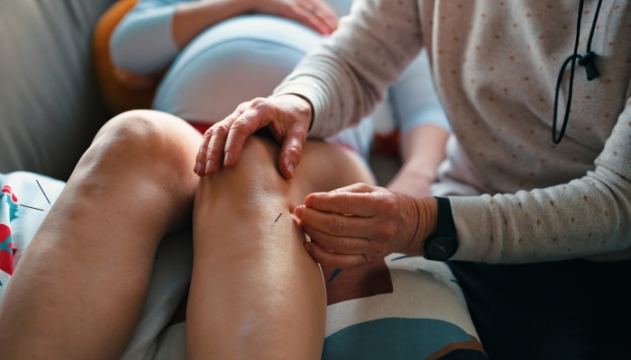 Pregnant woman getting acupuncture treatment.