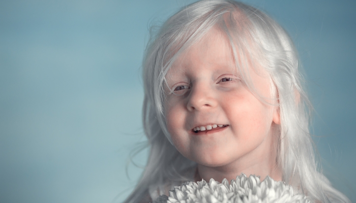 Portrait of a beautiful albino girl with white Aster flowers.