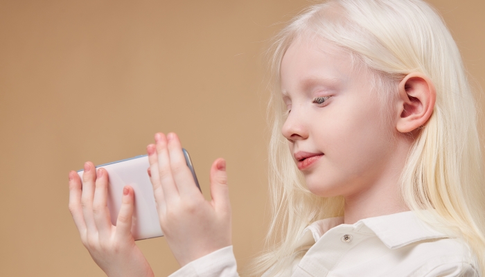 Beautiful albino child holding white smartphone.