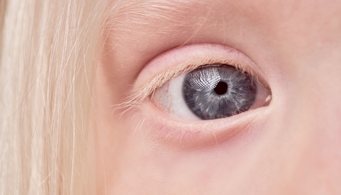 Close-up mystic photo of albino child eye.