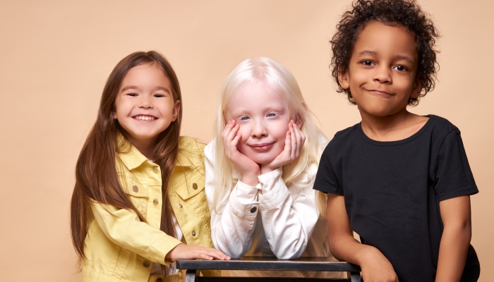 Girl with albinism syndrome is friends with black african boy and american girl.