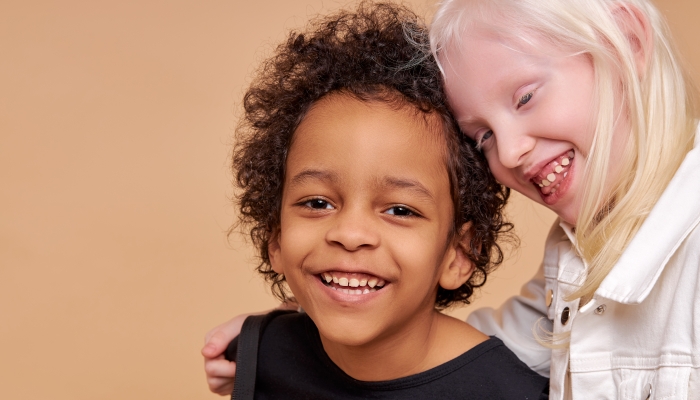 Lovely girl with albinism syndrome leaned on boy.