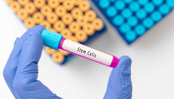 Blood sample tube contain stem cells for cell therapy.