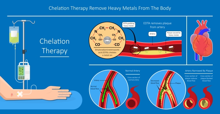 Chelation Therapy.